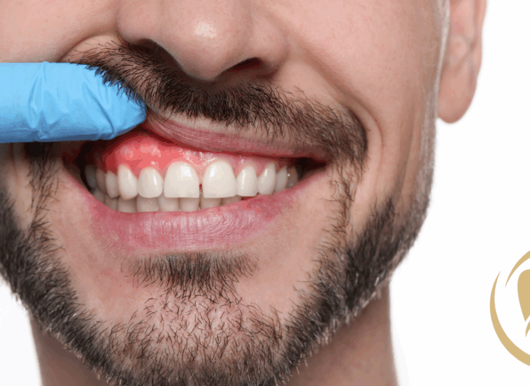 Why Gum Disease Is More Than a Dental Problem - New Braunfels Dentists