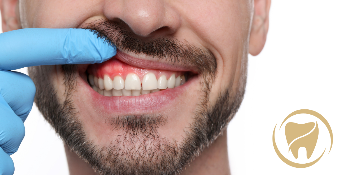 Why Gum Disease Is More Than a Dental Problem - New Braunfels Dentists